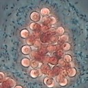 Mikrobiologisk analys, 3 parametrar